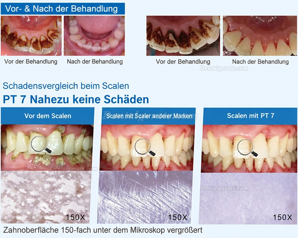 Refine PT 7 Ultraschallscaler Parodontalbehandlungsger&auml;t mit Wasserflasche
